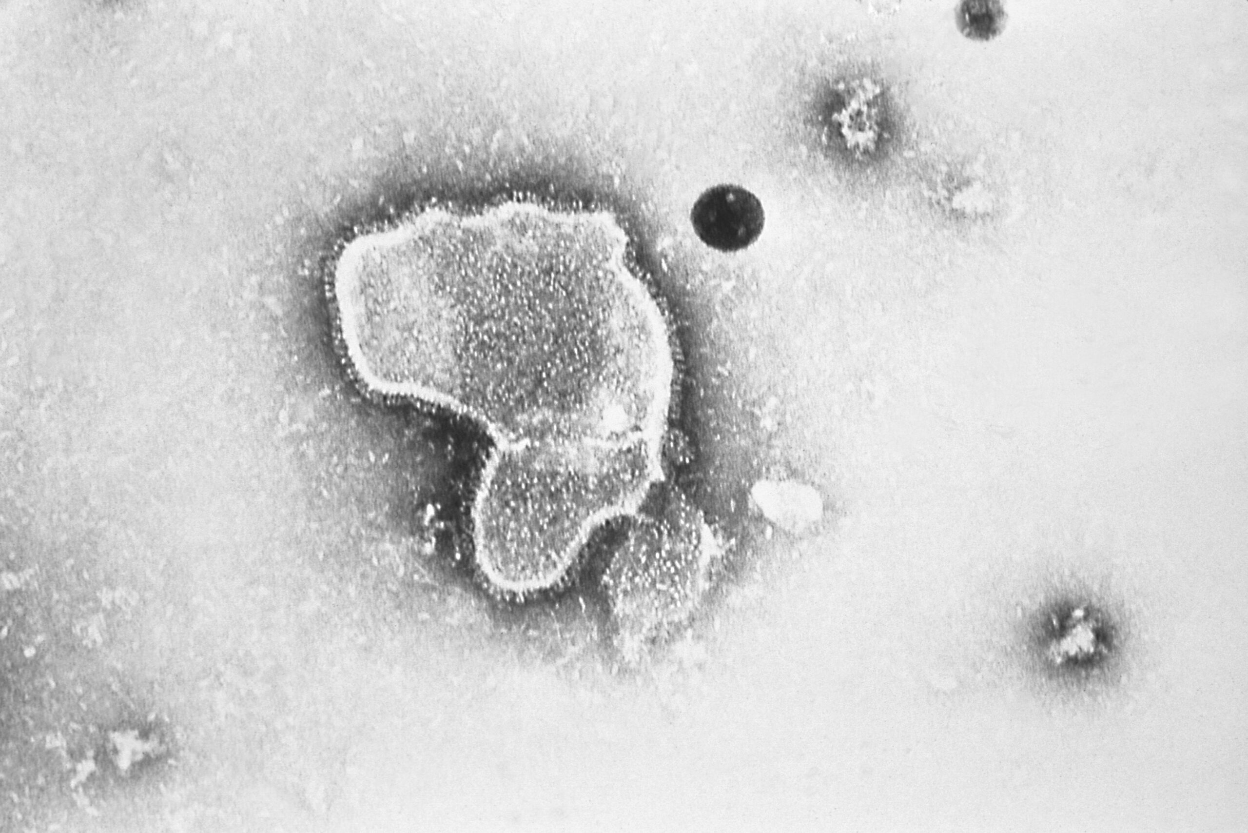 An electron micrograph of Respiratory Syncytial Virus, also known as RSV.